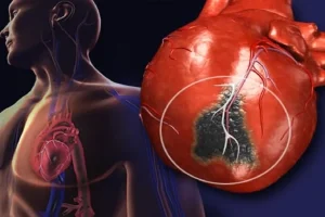 این نشانه ها یعنی حمله قلبی به شما دست داده است + علائم