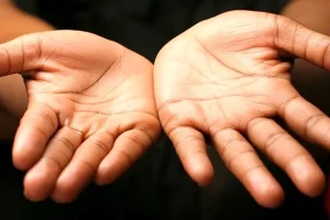 تست شخصیت شناسی | بگو کف دستت چه شکلیه تا بگم چطوری و چه زمانی ازدواج میکنی