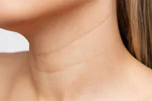 یک روش خانگی برای از بین بردن چین و چروک گردن