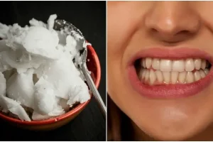 بدون نیاز به هزینه های سرسام آور دندان پزشکی دندوناتو مثل برف سفید کن | یک روش خانکی و بسیار ارزان برای داشتن دندان بلوری