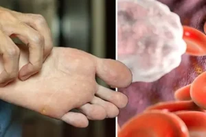 هشدار؛ این علائم رو گه 80 درصد مردم دارن رو جدی بگیرید | فورا به دکتر مراجعه شود
