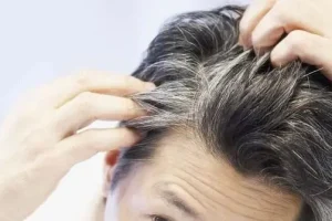 از ظاهر موی سر این ۶ وضعیت سلامتی را شناسایی کنید