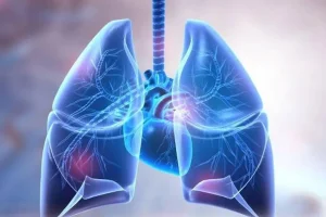 هشدار ! این افراد در معرض ابتلا به بیمارى هاى ریوى