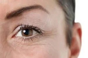 چین و چروکها بر روی صورت شما زیاد شده است ؟ بخوانید