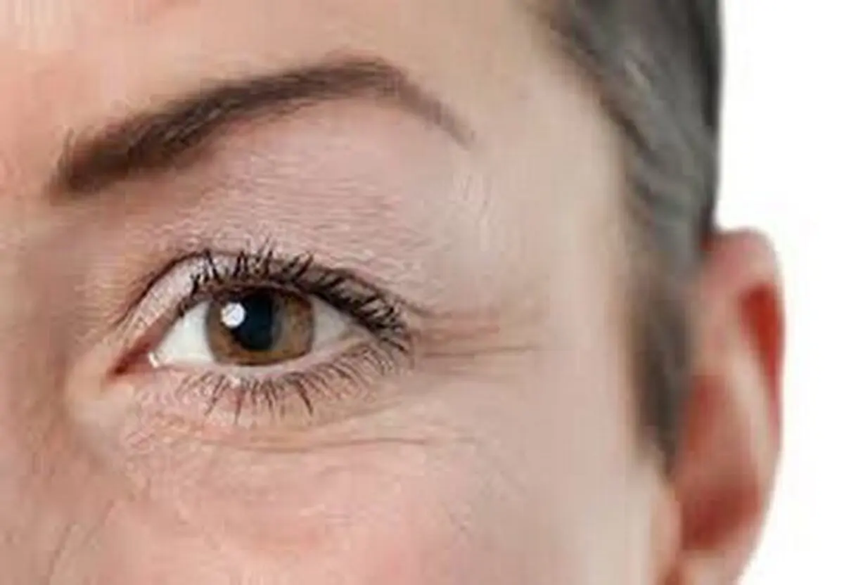 چین و چروکها بر روی صورت شما زیاد شده است ؟ بخوانید