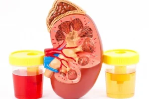 این علائم در ادرار بسیار خطر ناک است / مراقب باشید