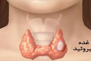 این علائم هشدار دهنده مشکلات در غده تیروئید است