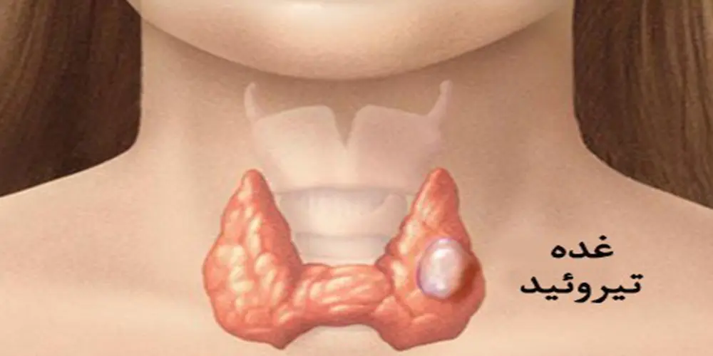 این علائم هشدار دهنده مشکلات در غده تیروئید است