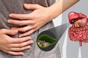 جلوگیری از سنگ‌های کلیه و صفرا با این روغن