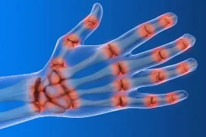 اگر این علائم را در دستتان دارید به شدت خطرناک است