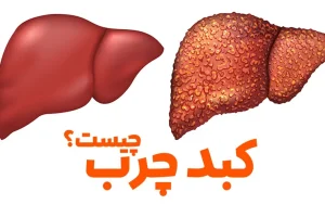 این گیاه ایرانی کبد شما را نجات می دهد
