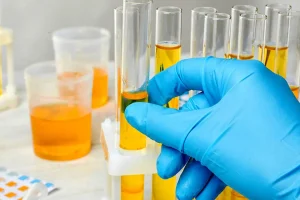 کدام تغییر رنگ ادرار خطرناک است؟