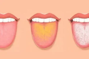 دیگه برای تشخیص بیماری ها نیاز به آزمایش و چکاپ گران قیمت نیست | بگو زبونت چه رنگیه تا تمام مشکلات بدنت رو بگم
