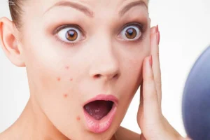 مهمونی دعوتی و جوش مجلسی زدی؟ با این روش سه سوته نابودش کن