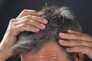 روش های کاهش سرعت سفید شدن مو | این موهای سفید را می تواند دوباره مشکی کنید