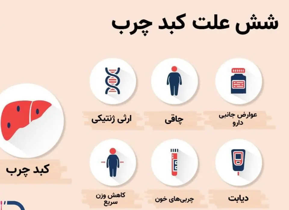 این نوشیدنی ها کبد چرب را به شما هدیه می دهد