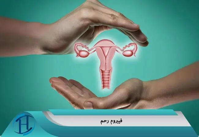 این علائم نشانه درد فیبروم رحمی است | جدی بگیرید
