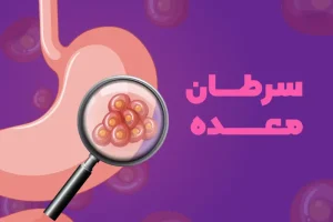 سوزش سردل همراه با این علائم نشانه سرطان معده است | با این راهکارها از سرطان معده در امان بمانید