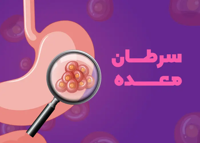 سوزش سردل همراه با این علائم نشانه سرطان معده است | با این راهکارها از سرطان معده در امان بمانید