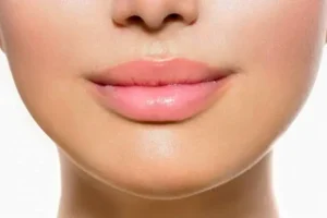 تا عید امسال با این گیاه دماغت رو کوچیک کن | بینی خوش فرم با این گیاه ارزان قیمت