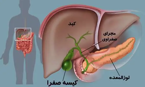 این هفت علامت یعنی لوزالمعدهتان بیمار است
