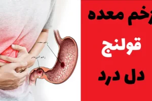 درمان قولنج معده، کتف و کمر در منزل؛ راه کارهای اقتصادی و مقرون به صرفه!