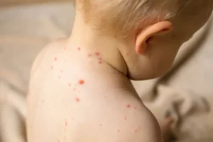 هشدار جدی، اگر این علائم را دارید خونتان عفونت کرده است