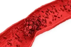 این علائم میگه یه جای بدنت خون لخته شده!