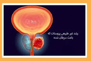 این کار خطر ابتلا به سرطان پروستات را کاهش می دهد