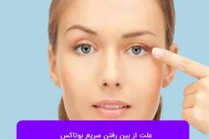 میخوای عمر بوتاکس دو برابر شه این مطلبو از دست نده