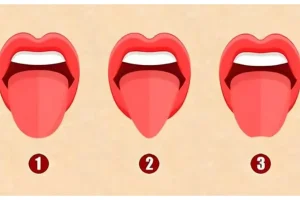 تست شخصیت شناسی | میدوسنتی فرم زبان آدم ها میتونه رازهای اونارو لو بده؟