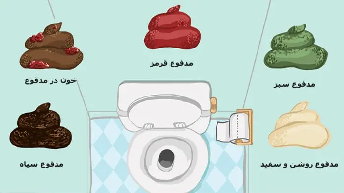 اگر این نشانه را در مدفوع دارید به پزشک مراجعه کنید