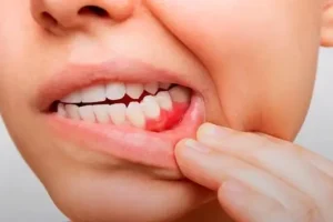 اگر این سبزی محلی ارزان قیمت رو مصرف کنی تا عمر داری پات به دندون پزشکی باز نمیشه