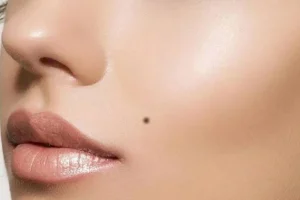 خال کجای بدن باشه نشونه خوبی هست؟ | بگو کجای بدنت خال داری تا بگم نشونه چیه