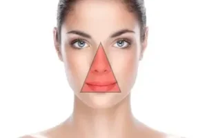 مثلث مرگ در صورت | درآوردن جوش‌های سرسیاه در این ناحیه خبر از مرگ زودرس می دهد
