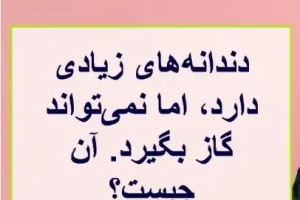 چیستان روز | آن چیست که دندانه‌های زیادی دارد، اما نمی‌تواند گاز بگیرد؟