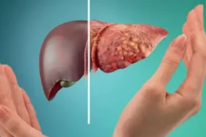 علائمی که در پاهای شما در مورد مشکلات کبدی هشدار می دهد