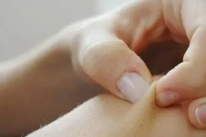 پوست شما چند ساله است؟ تست ۶۰ ثانیه‌ای نیشگون که متخصصان پوست توصیه می‌کنند