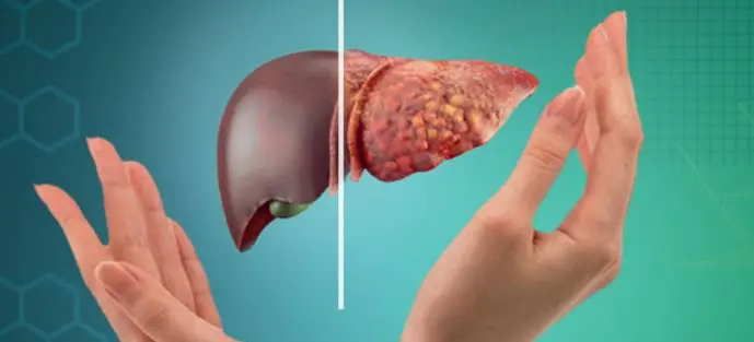 پاکسازی کبد با این گیاه ترش مزه