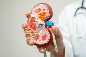 نگران سلامتی کلیه‌هات نباش! | این ۶ خوراکی بی‌نظیر برای کلیه معجزه می‌کنه