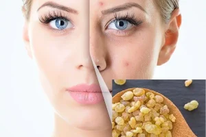 خواص ضدپیری این گیاه ارزشمند؛ لیفت و درخشندگی و جوانسازی پوست با کندر