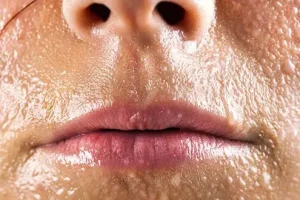 هشدار مرگبار؛ اگر بیش از حد عرق می کنید فورا بخوانید